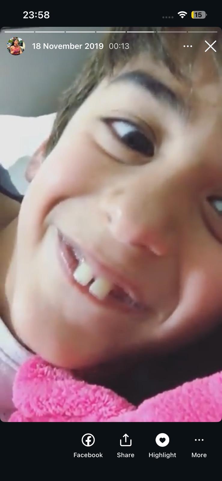 Buckteeth